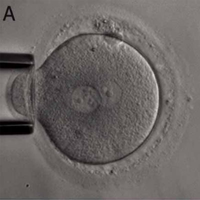 1-cell-embryo.png 1-cell-embryo.png